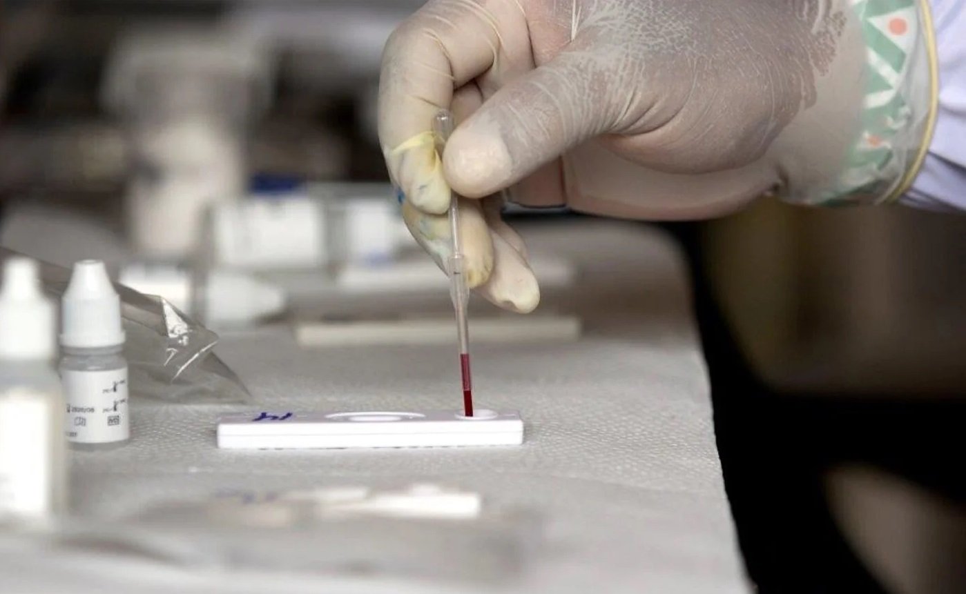Comité epidemiológico alerta por viruela del mono en México
